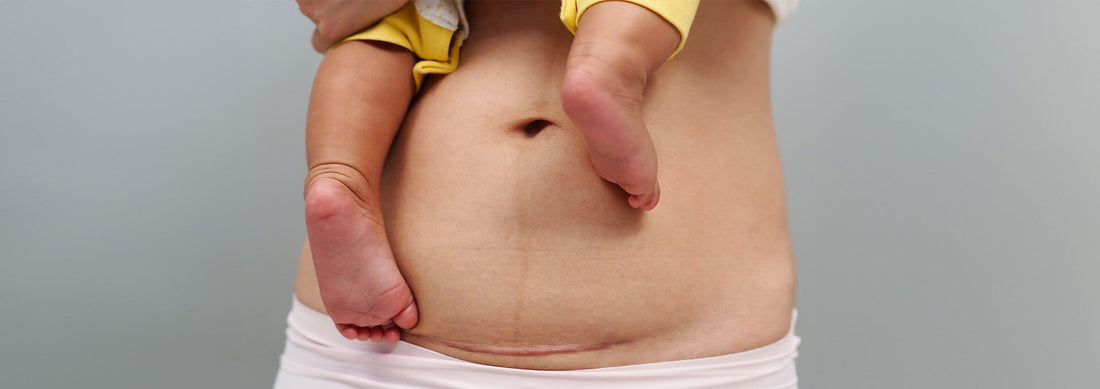 Récupération postpartum: à quoi s'attendre après l'accouchement