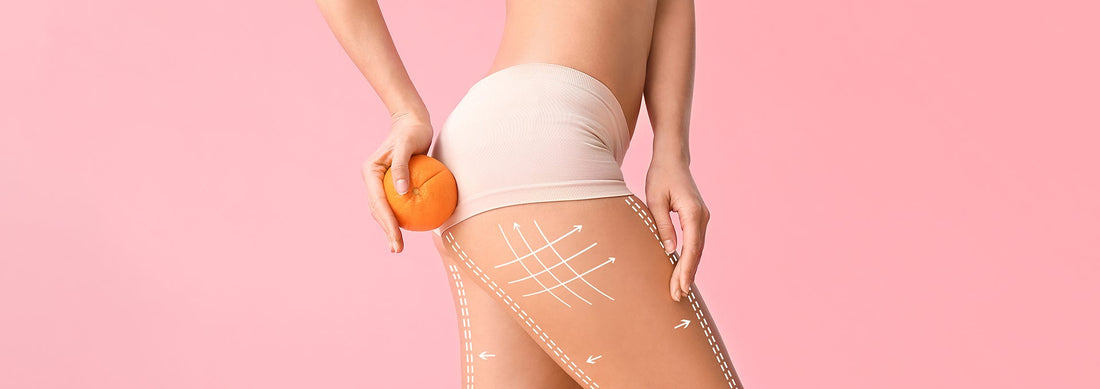 Il est possible de réduire la cellulite en un mois ! Voilà comment faire...