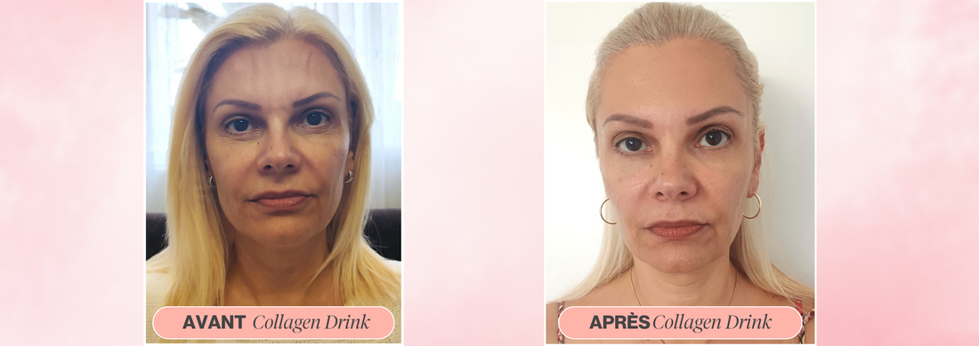 Katarina a refusé les traitements lourds pour rajeunir sa peau  à la place, elle a trouvé une solution naturelle