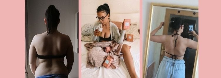 Lucie : J'ai 25cm sur tout le corps !